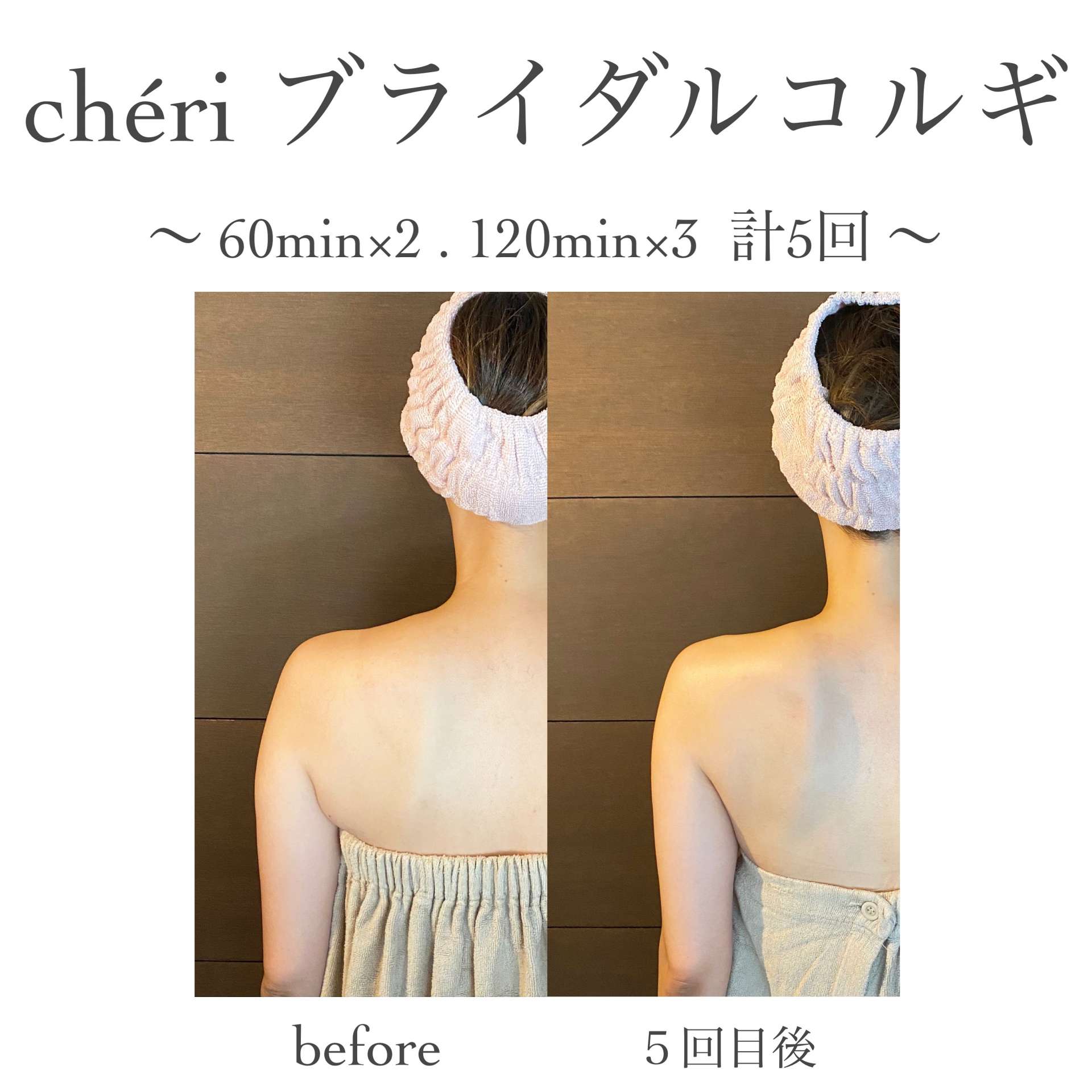 ブライダルコルギ効果